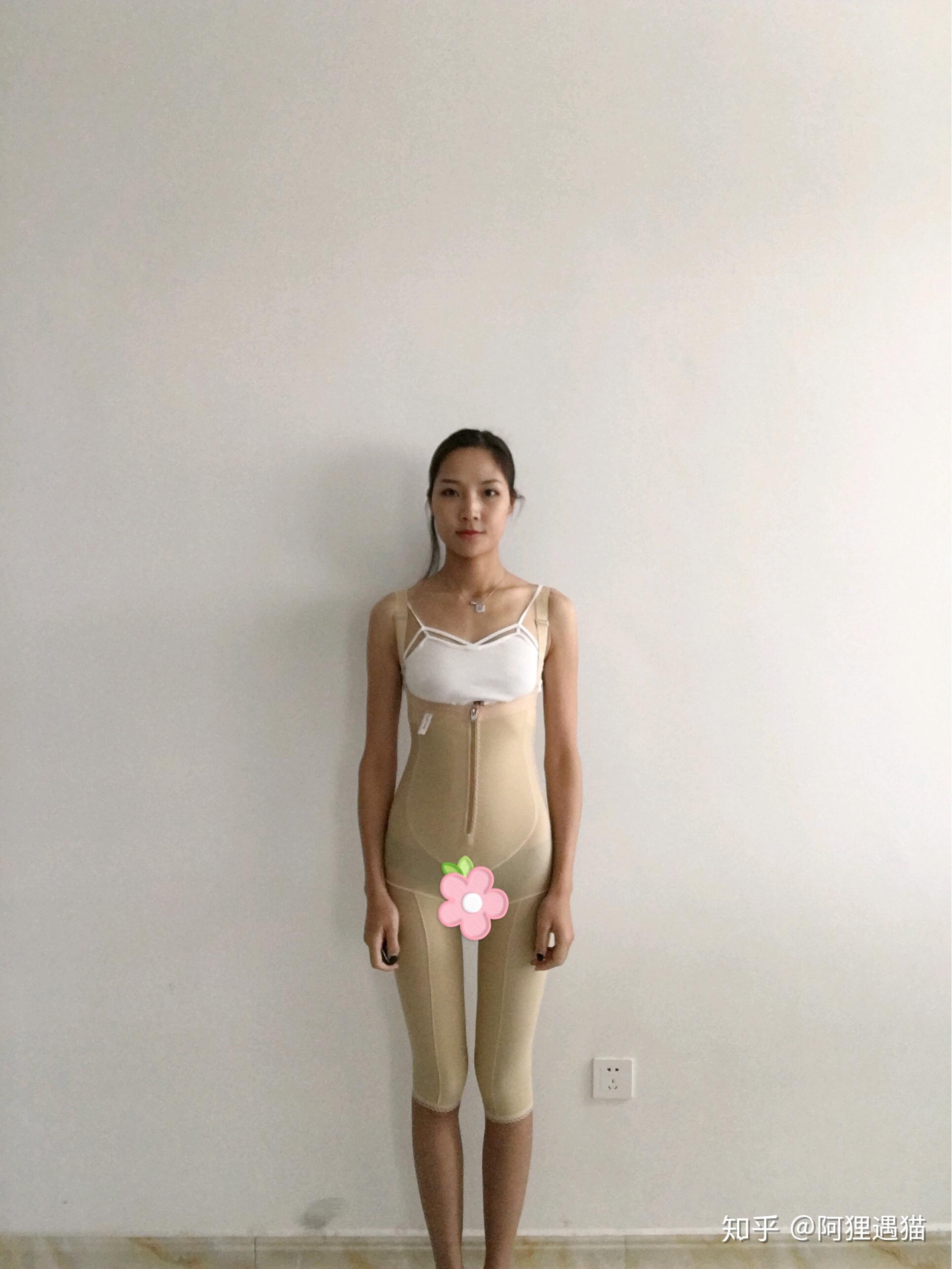 做腰腹部抽脂是一种什么样的感受? - 知乎