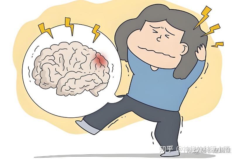 脑中风的前兆有哪些症状表现?如何预防? - 知乎