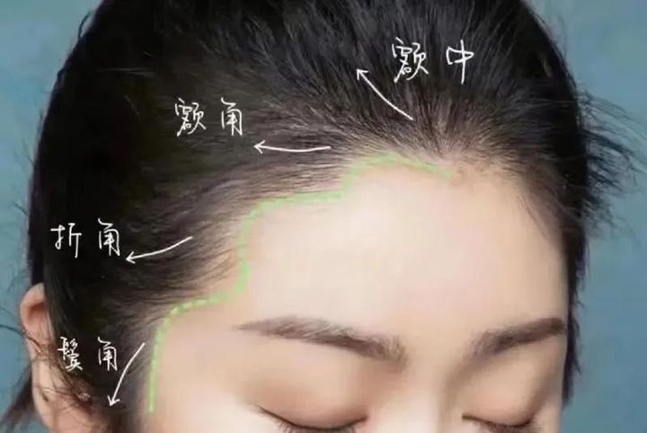 来深圳植发这3点要注意,提高植发成功率! - 知乎