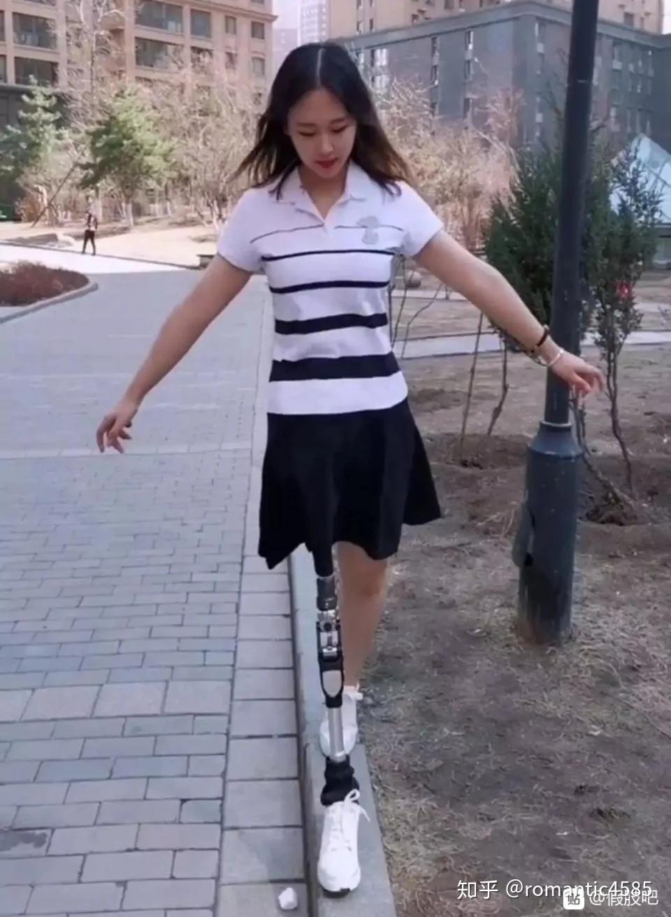 朋友因车祸右腿髋离断感觉她特别悲观我怕她一个人的时候想不开我该