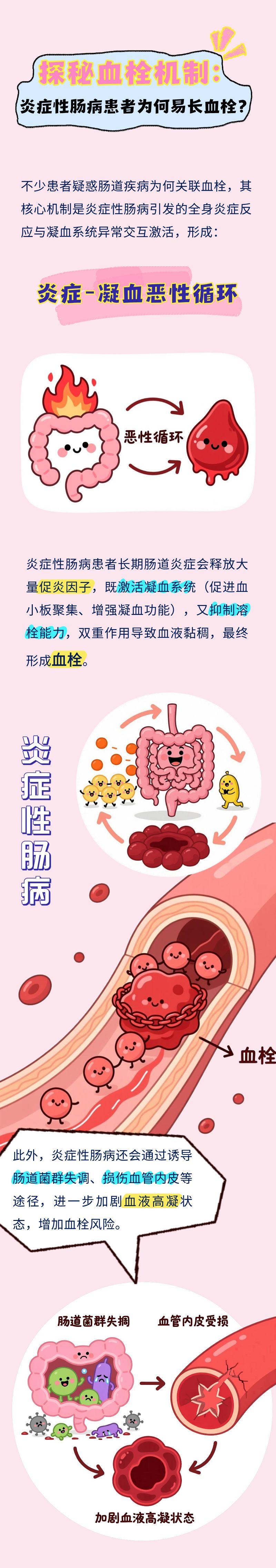 隐形杀手：当肠道炎症遭遇血栓危机 - 知乎