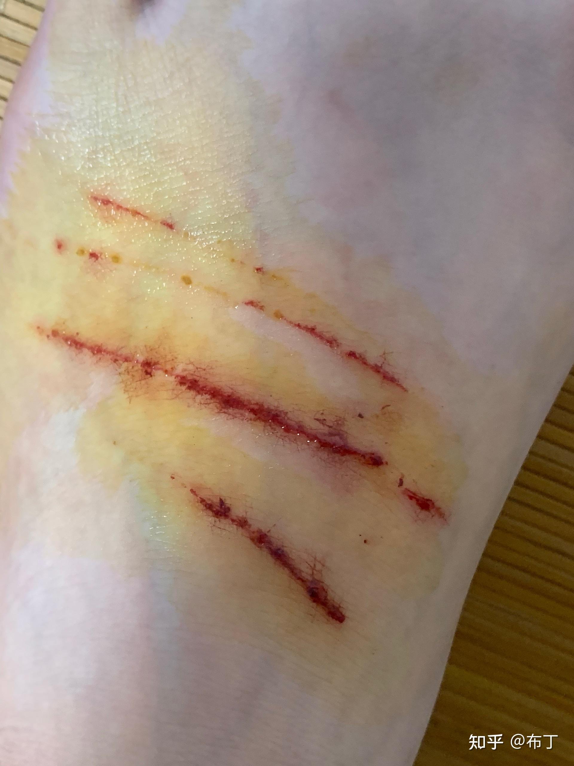 被家养的猫抓出血要打针吗