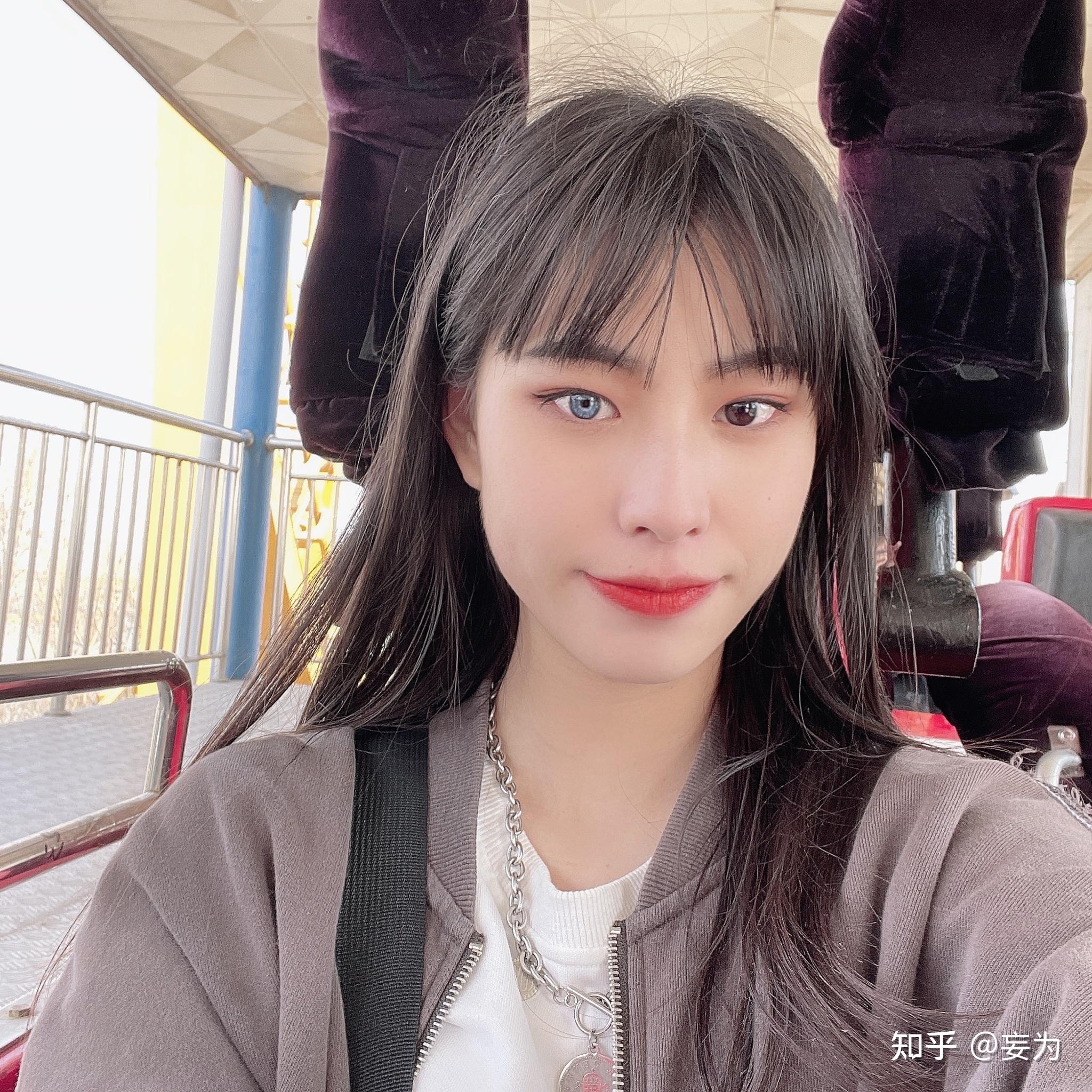 虹膜异色症是种怎样的体验