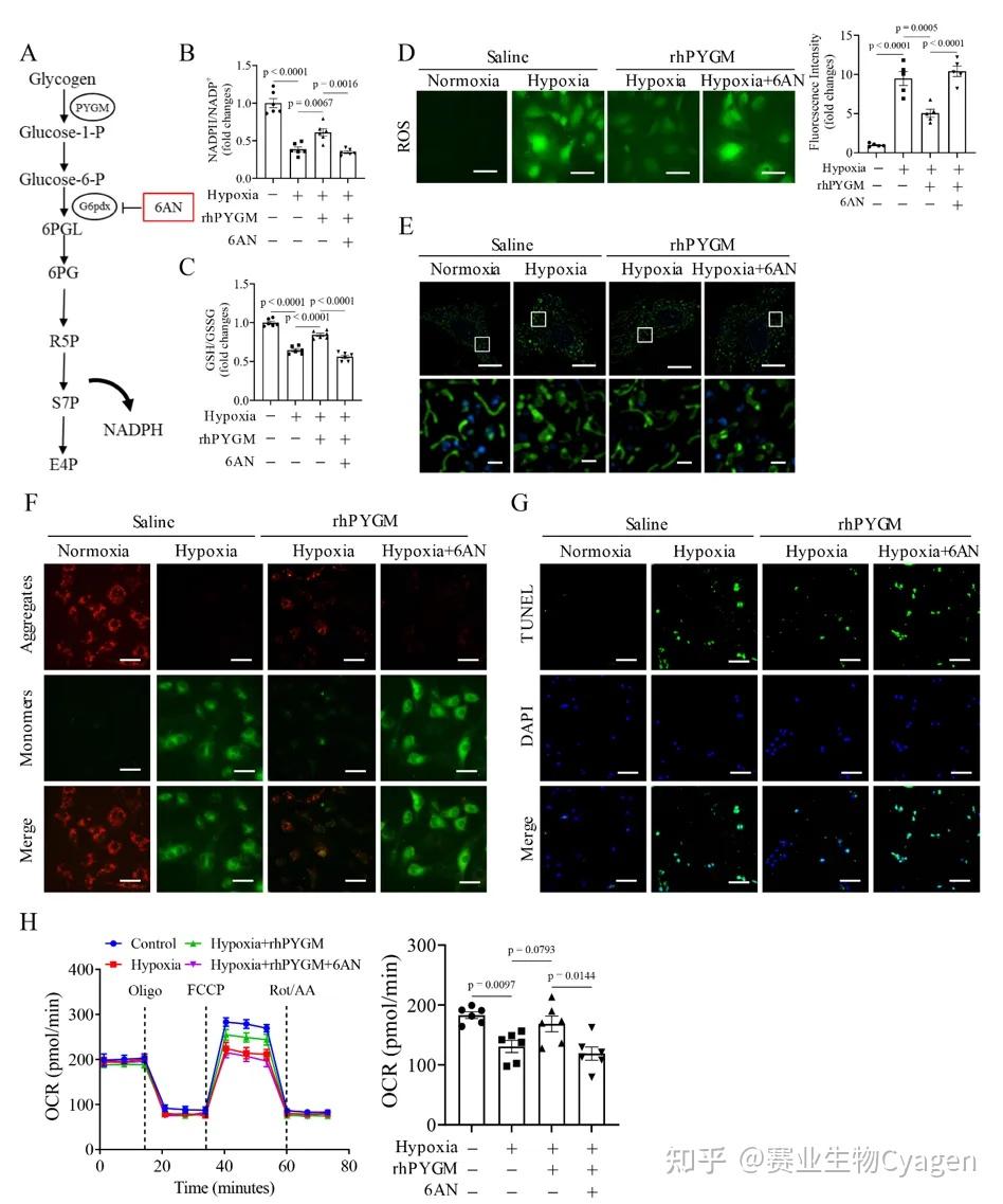 Circulation（IF=38.6）丨PYGM通过促进糖原分解与自噬流保护心肌梗死 - 知乎