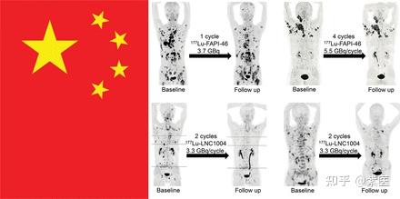 Jnm中国特刊：核药与核医学发展现状 知乎 