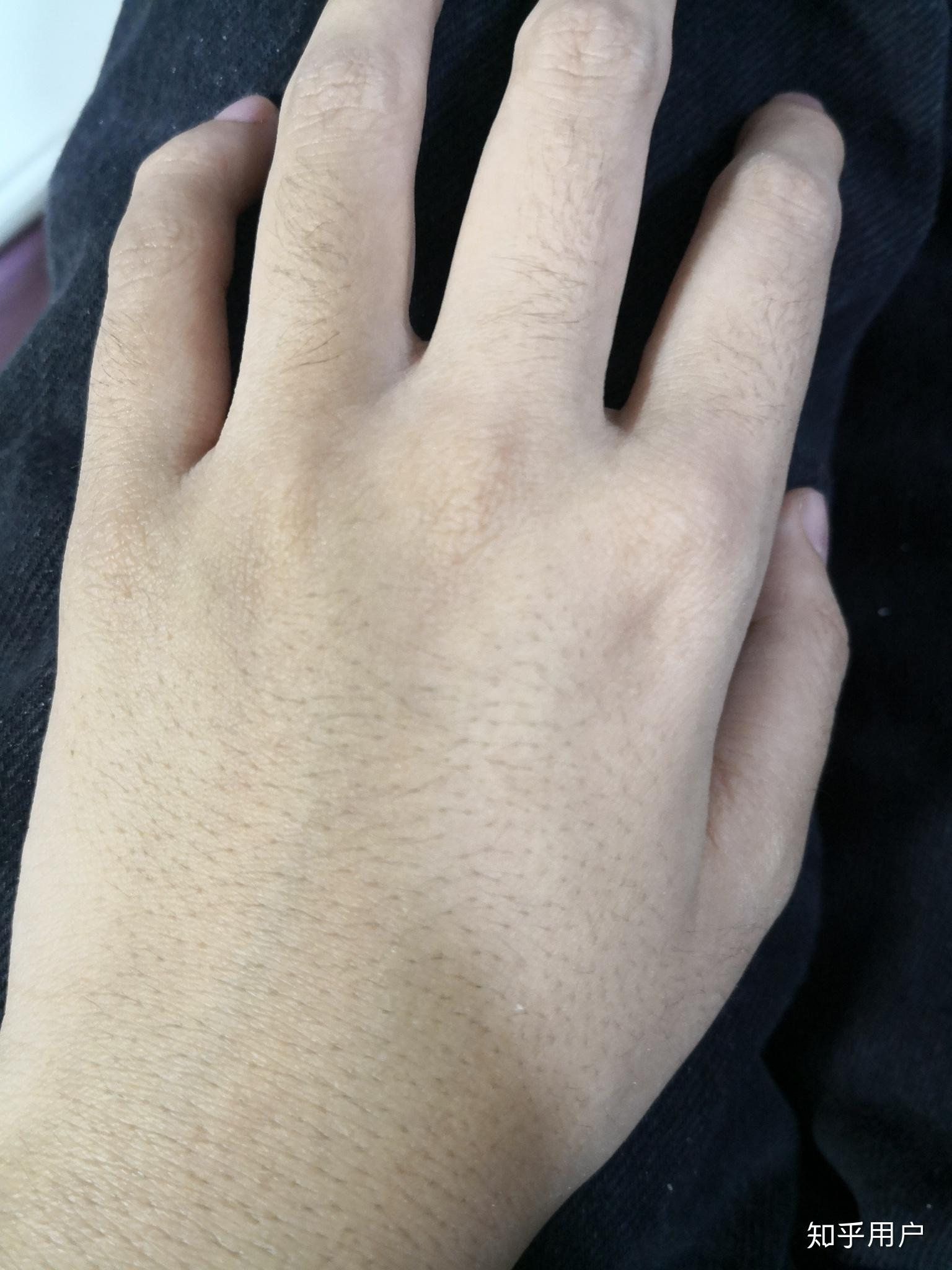 女生长浓密手毛是一种什么样的体验?