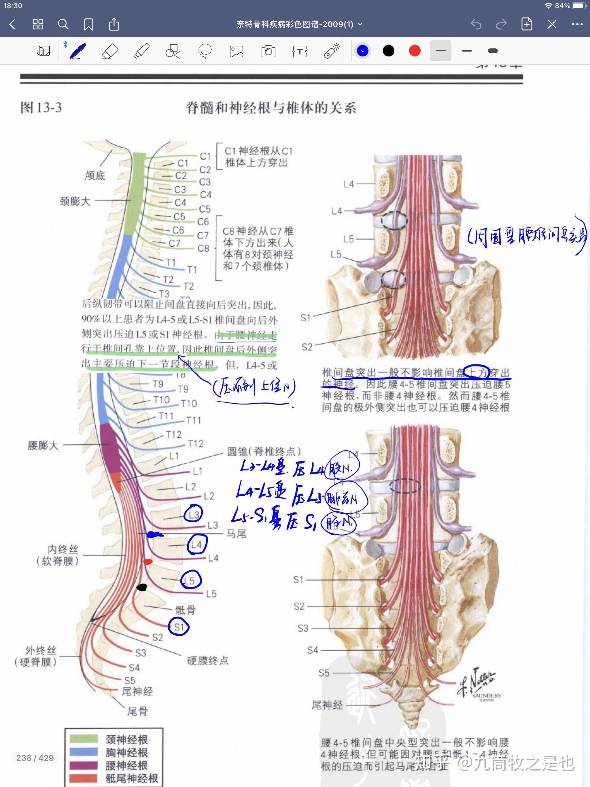 腰三到腰四之間的椎間盤突出會壓迫到哪條神經