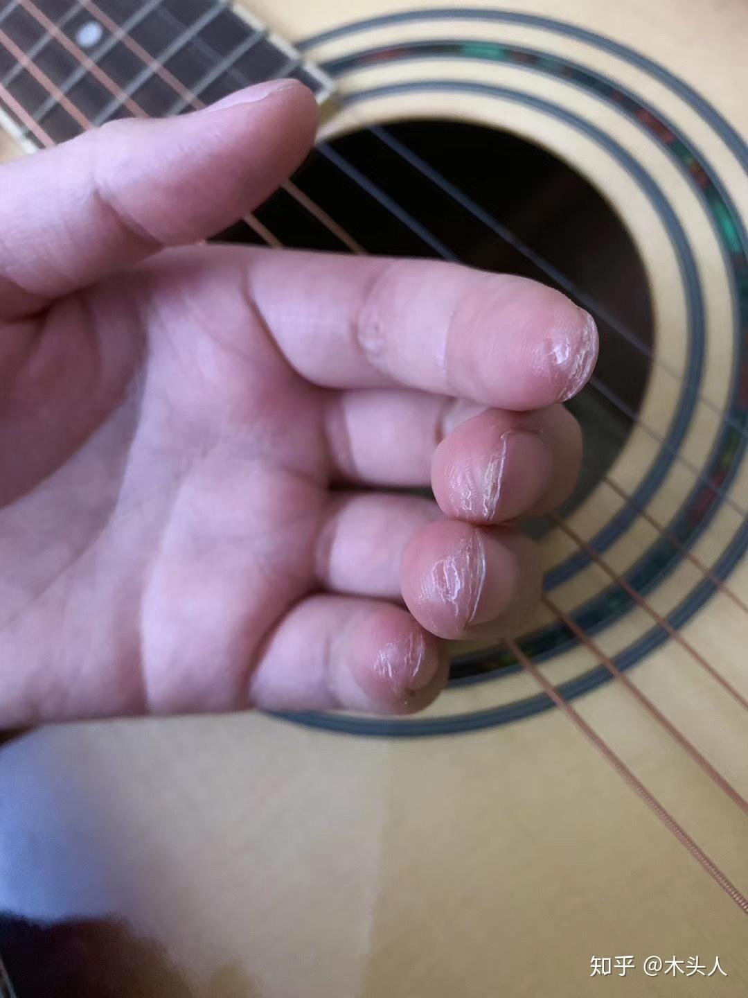 弹吉他手指疼怎么办图片