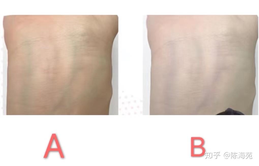 冷白皮和暖白皮怎么区别呀? - 知乎