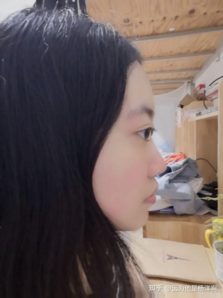 侧脸丑而正脸好看是一种什么体验