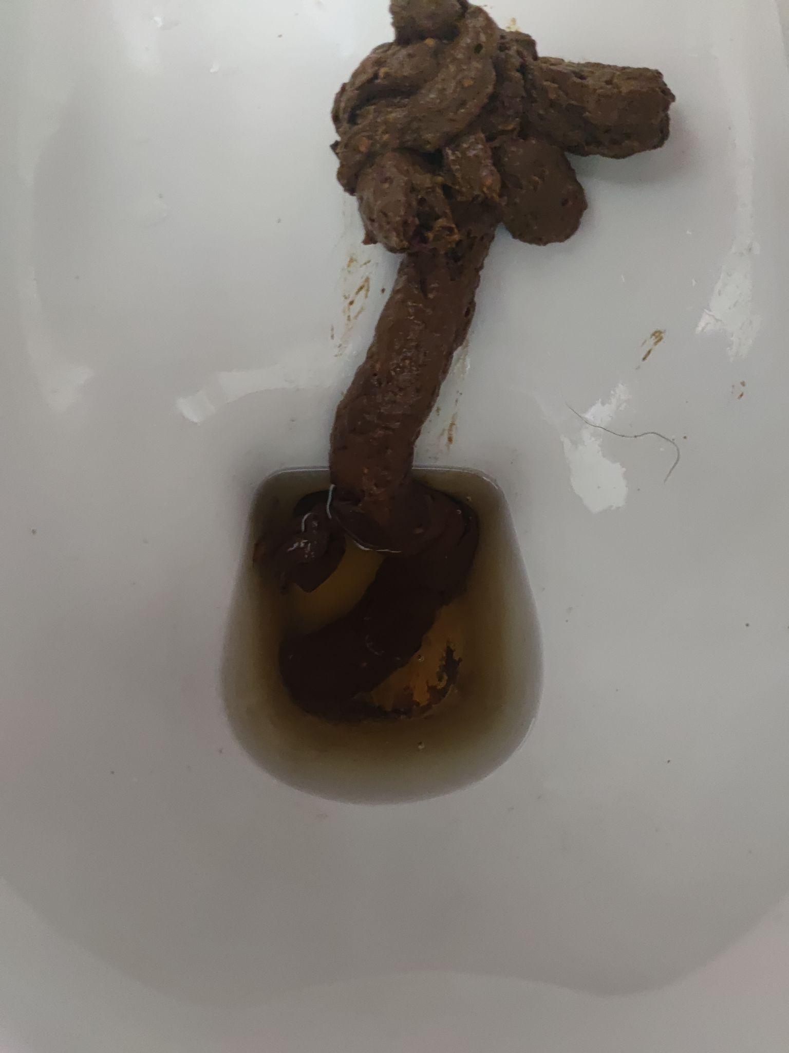 你们见过最大的屎是什么样的?