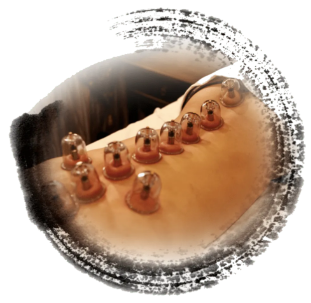 背部全息罐诊  怎么诊断