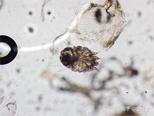 阿伏菌灵治疗一种新感染的斑腹猪幼崽疥螨 - 知乎