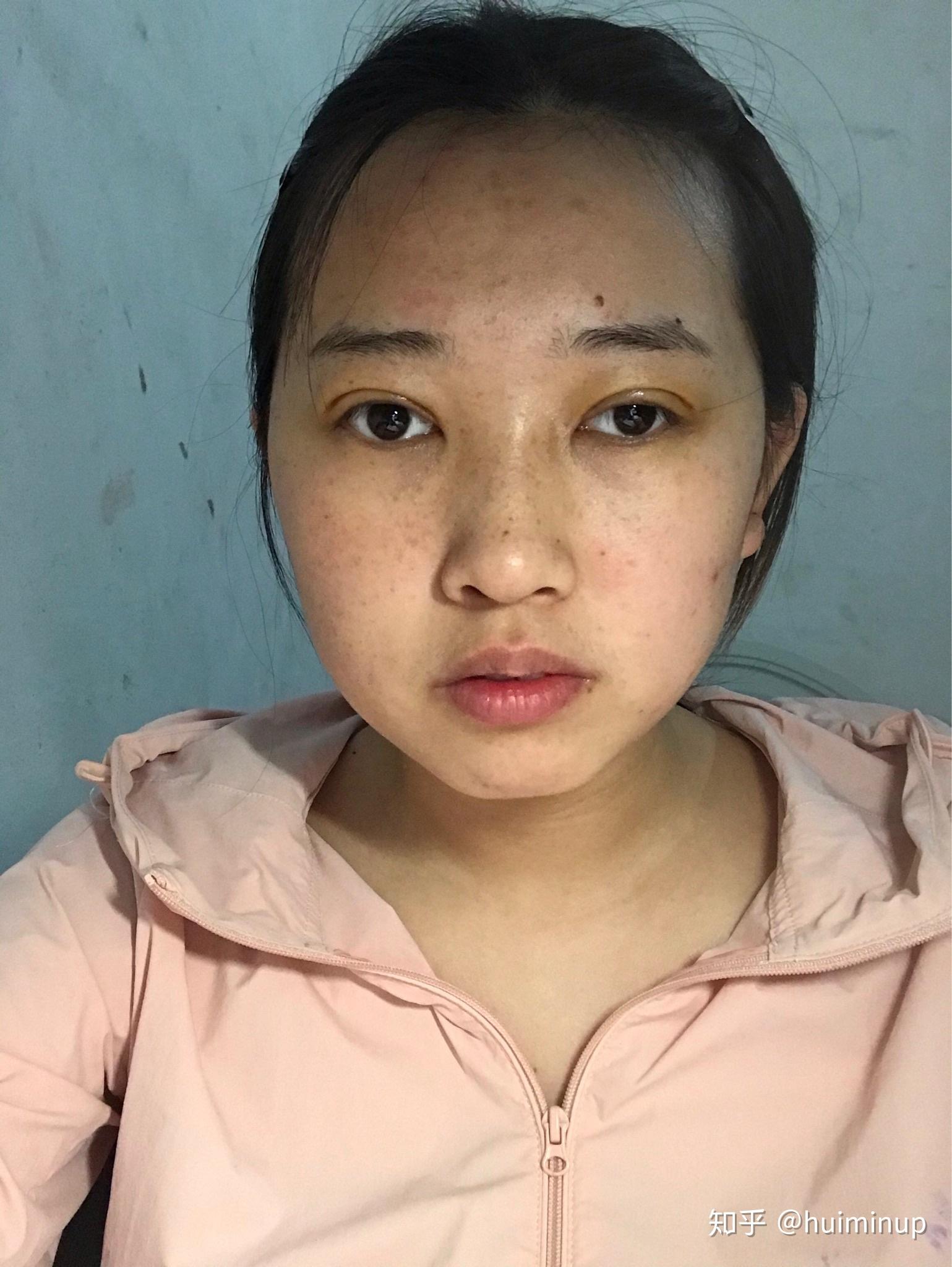左右脸不对称 知乎