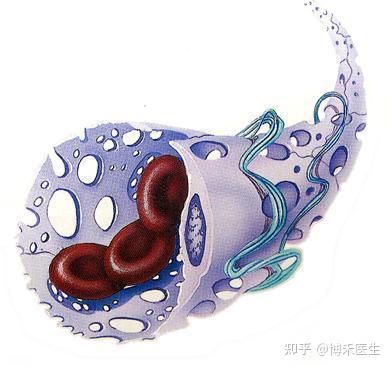 血窦是什么?应该怎么治疗? - 知乎