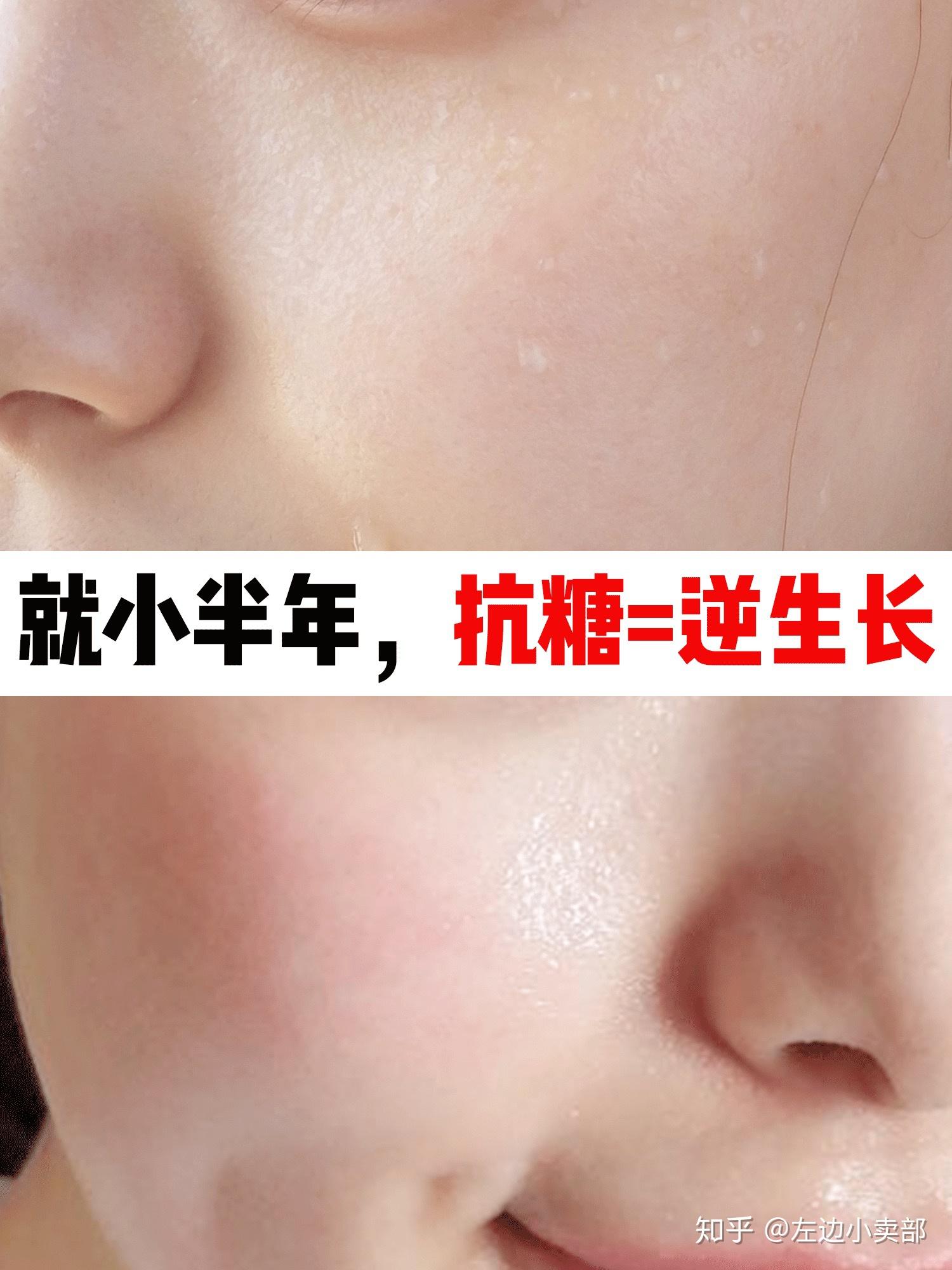 抗糖皮肤真的会好吗