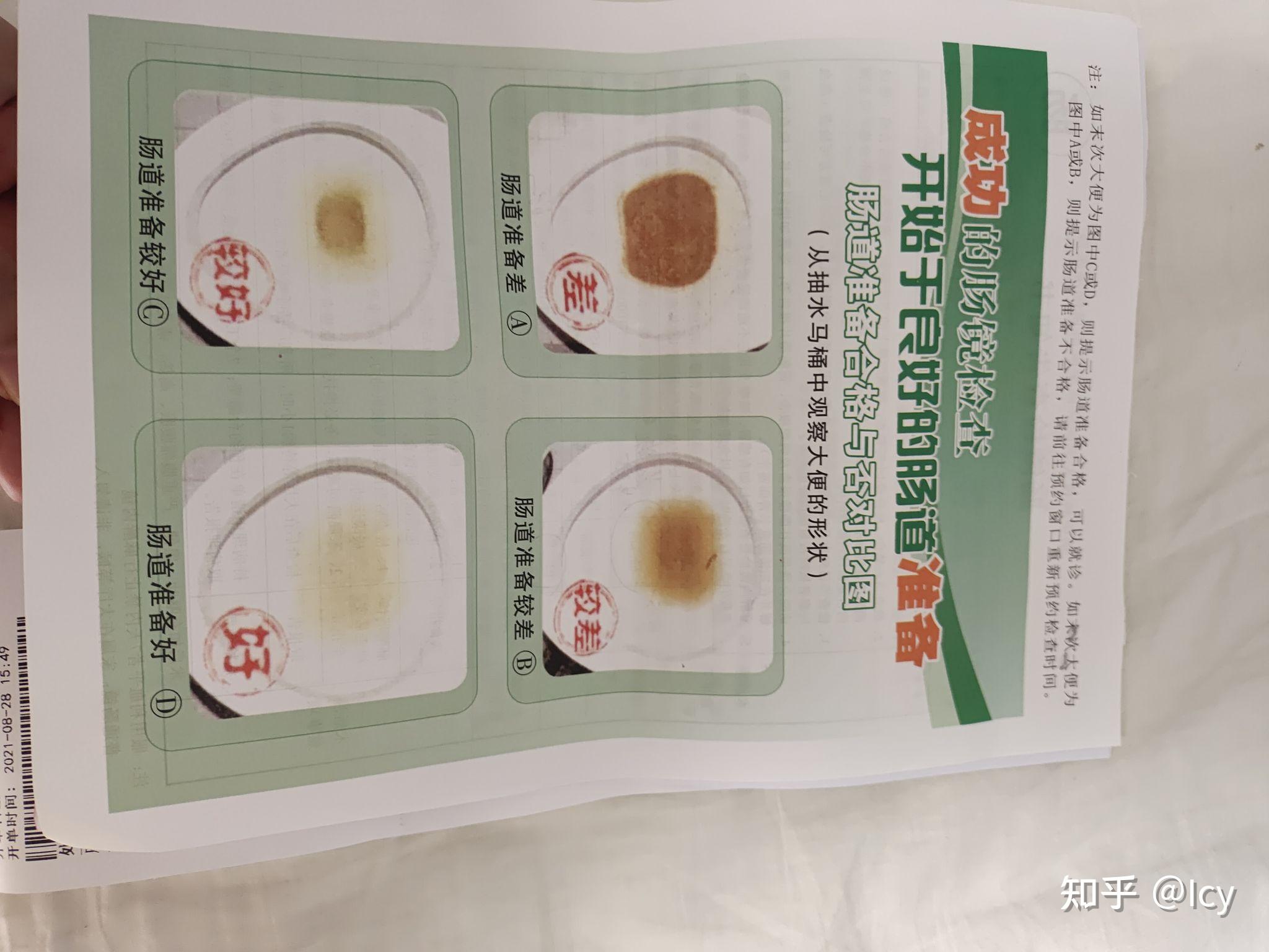 做无痛肠镜多少钱