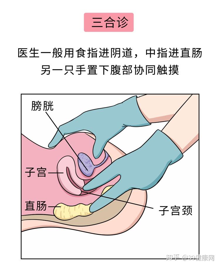 第一次去妇科检查是种怎样的体验