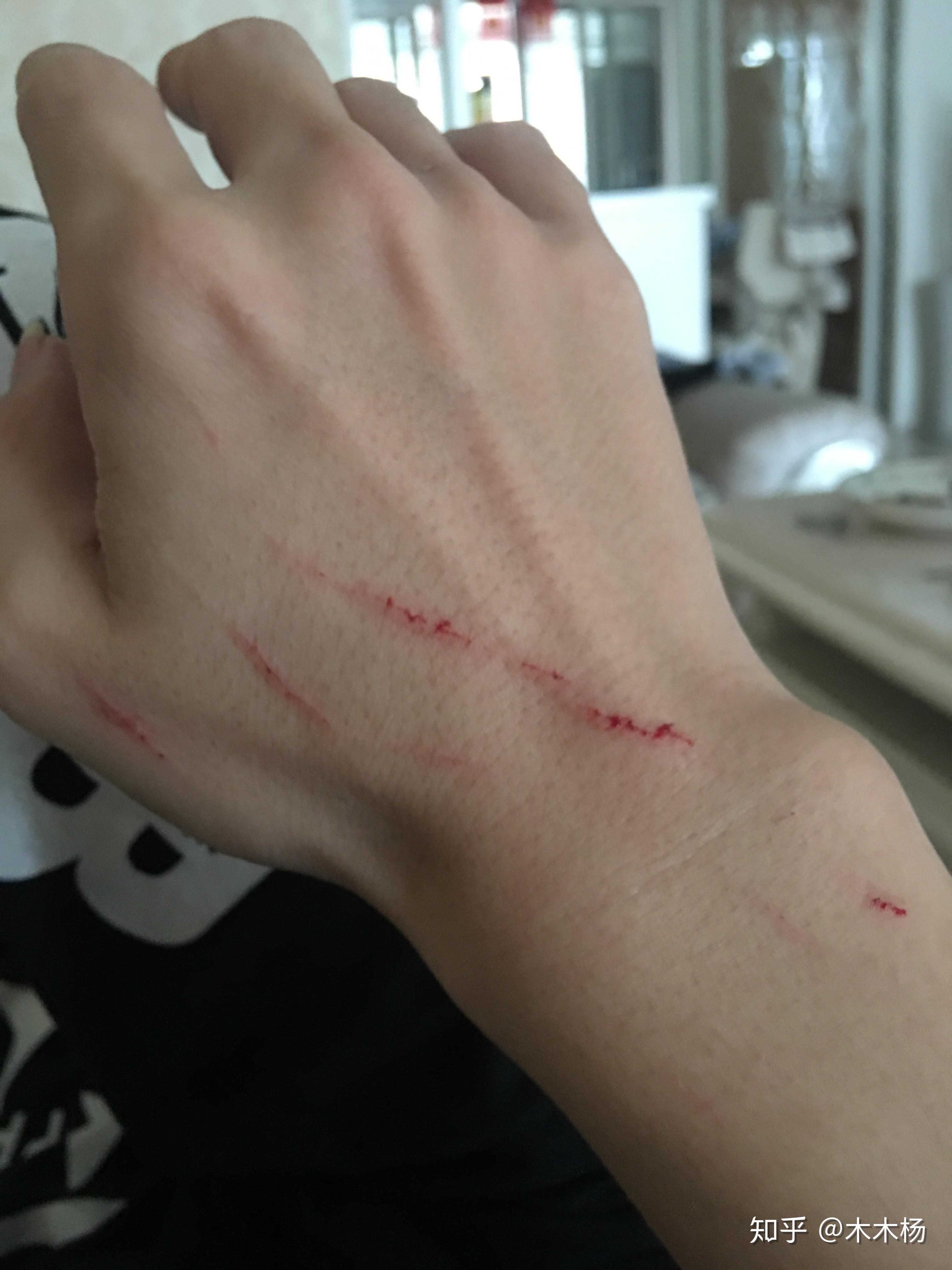 被猫抓伤之后,你会认为猫其实对主人没有情感嘛? - 知乎