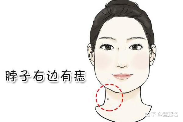 女人右侧腰部痣相图片