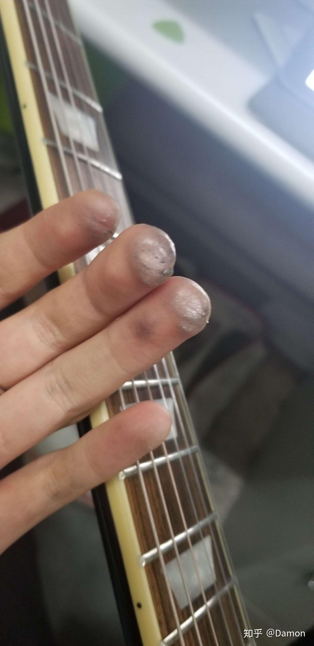 学吉他时手指这样了还练吗