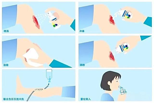 用于伤口创面的基因工程药——外用重组人碱性成纤维细胞生长因子 - 知乎