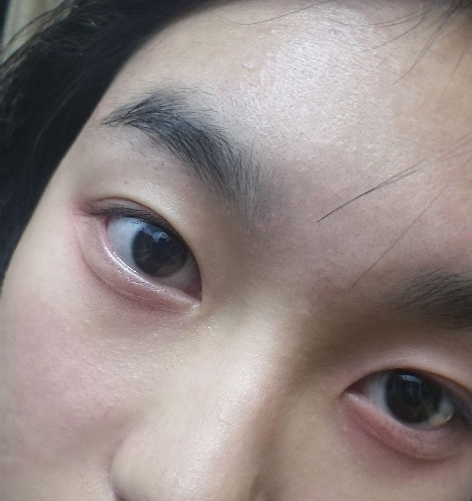 下眼睑上有一条不明显的线为什么有的人没有