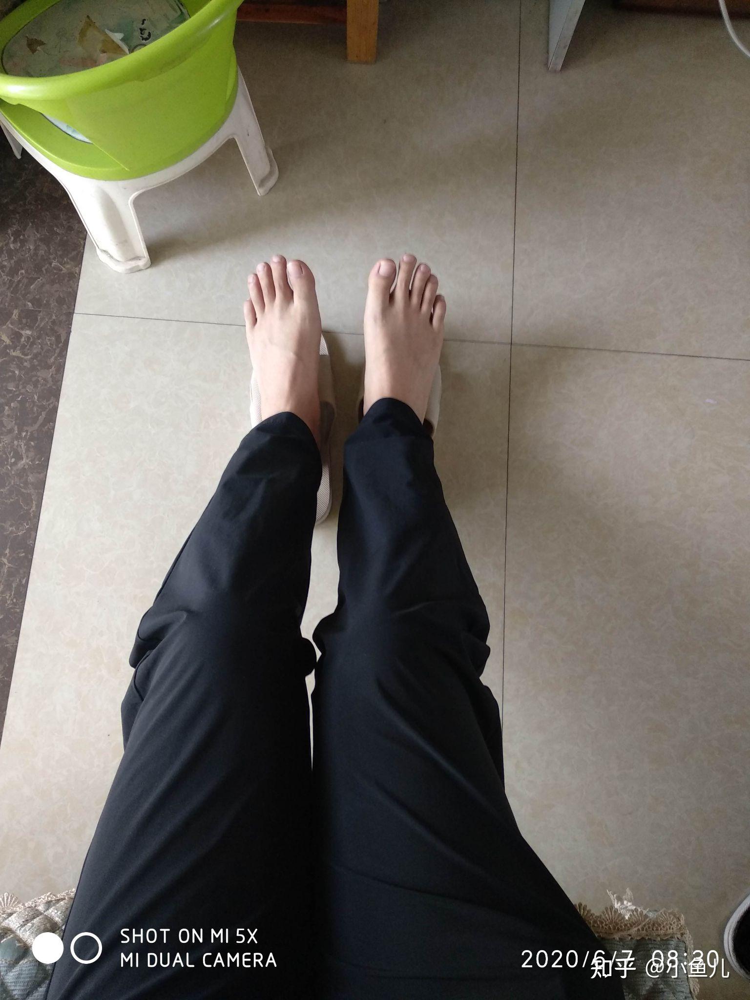 希腊脚是什么样的? - 知乎