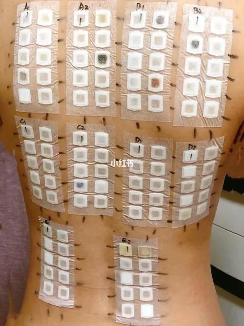 护发素化妆品hript人体重复性损伤性斑贴试验