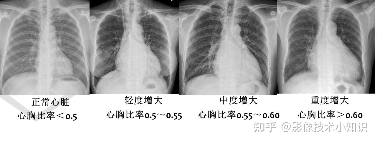 对你很有帮助的心脏影像知识 - 知乎