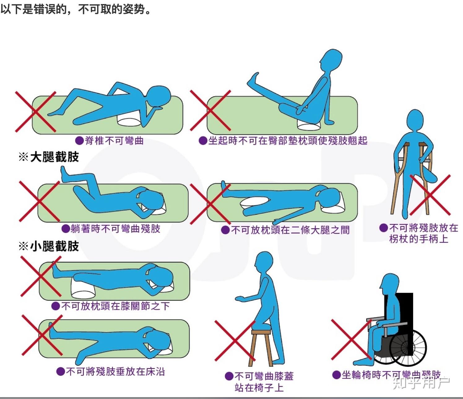 半足截肢患者如何选择假肢_优邦假肢矫形器上海有限公司_新浪博客