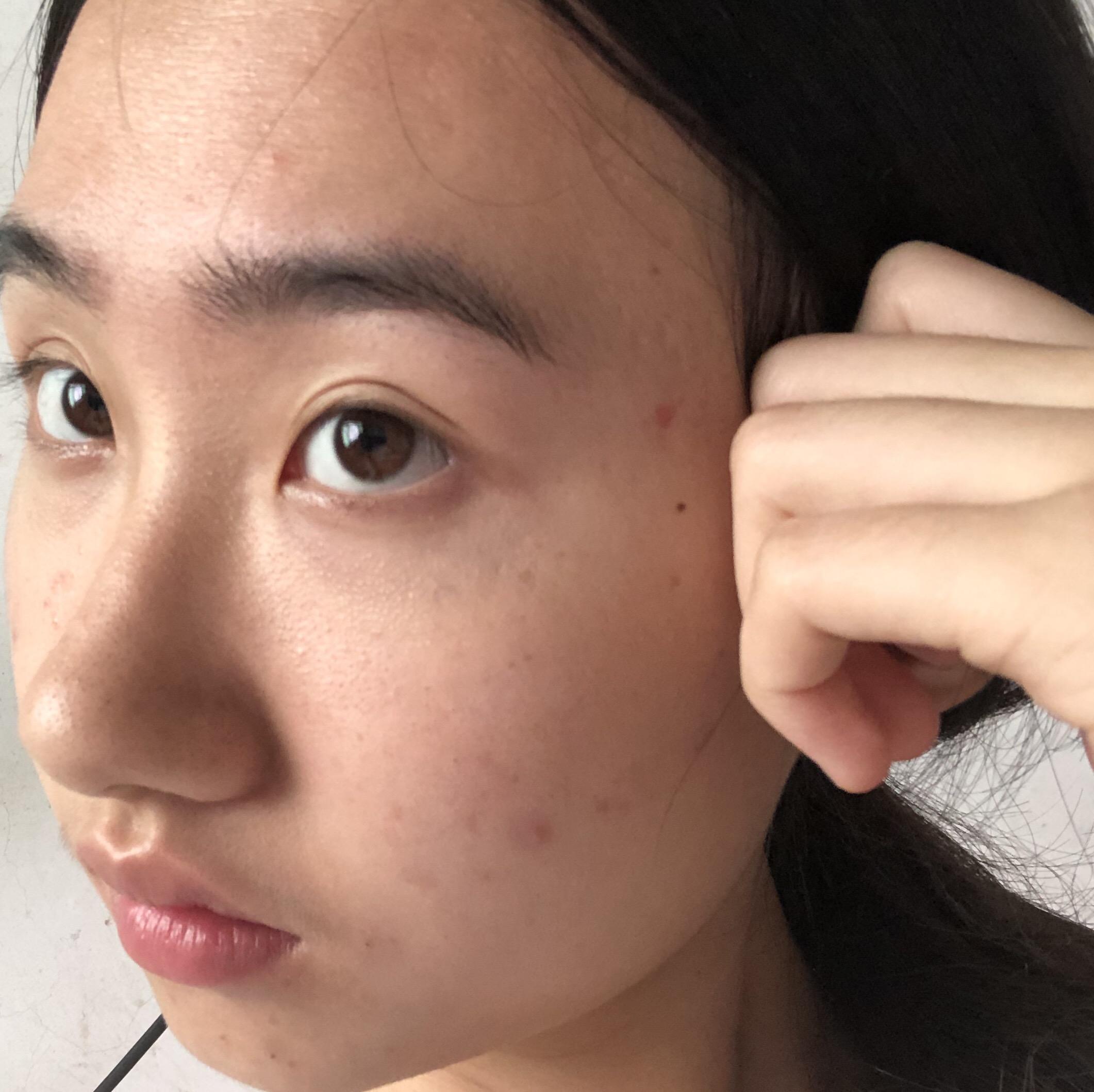 五官好看,皮肤差是种怎样的体验?