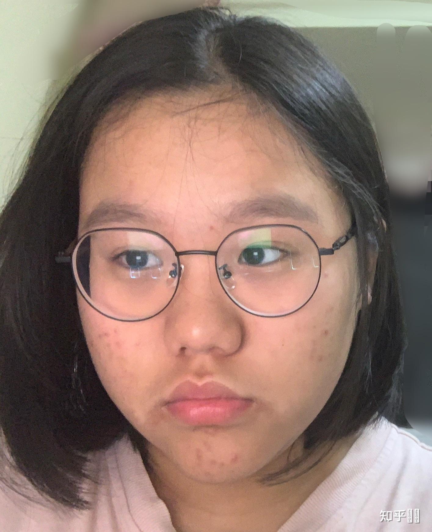 女生长得特别丑怎么办