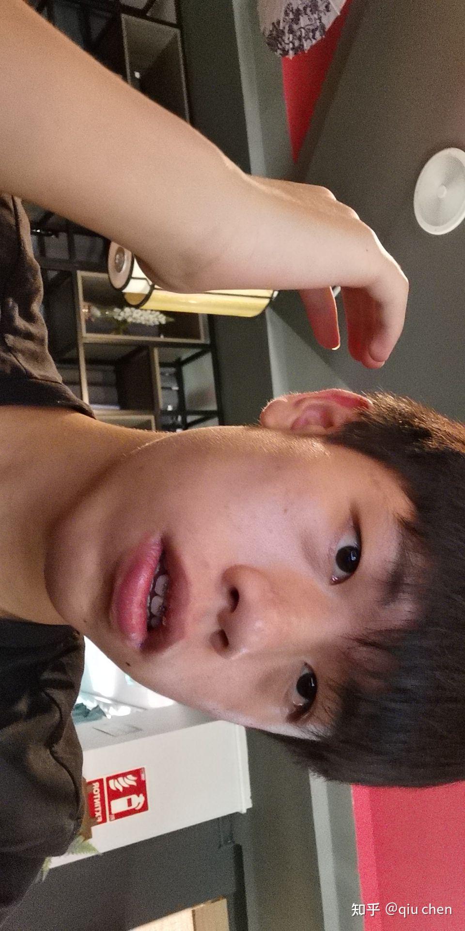 嘴唇厚的男生真的很丑吗