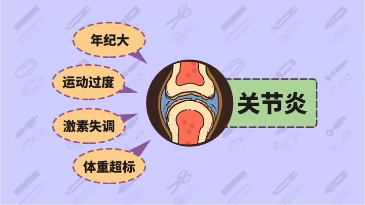 如何预防关节炎？收好这份关节使用说明书，保护关节，且行且珍惜！ 知乎 