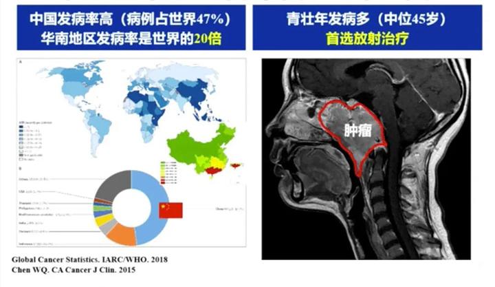 鼻咽癌患者放疗并发症的处理与指导 - 知乎
