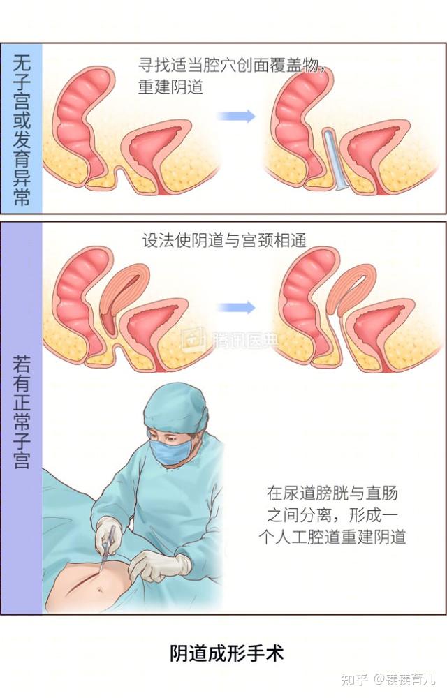 对于