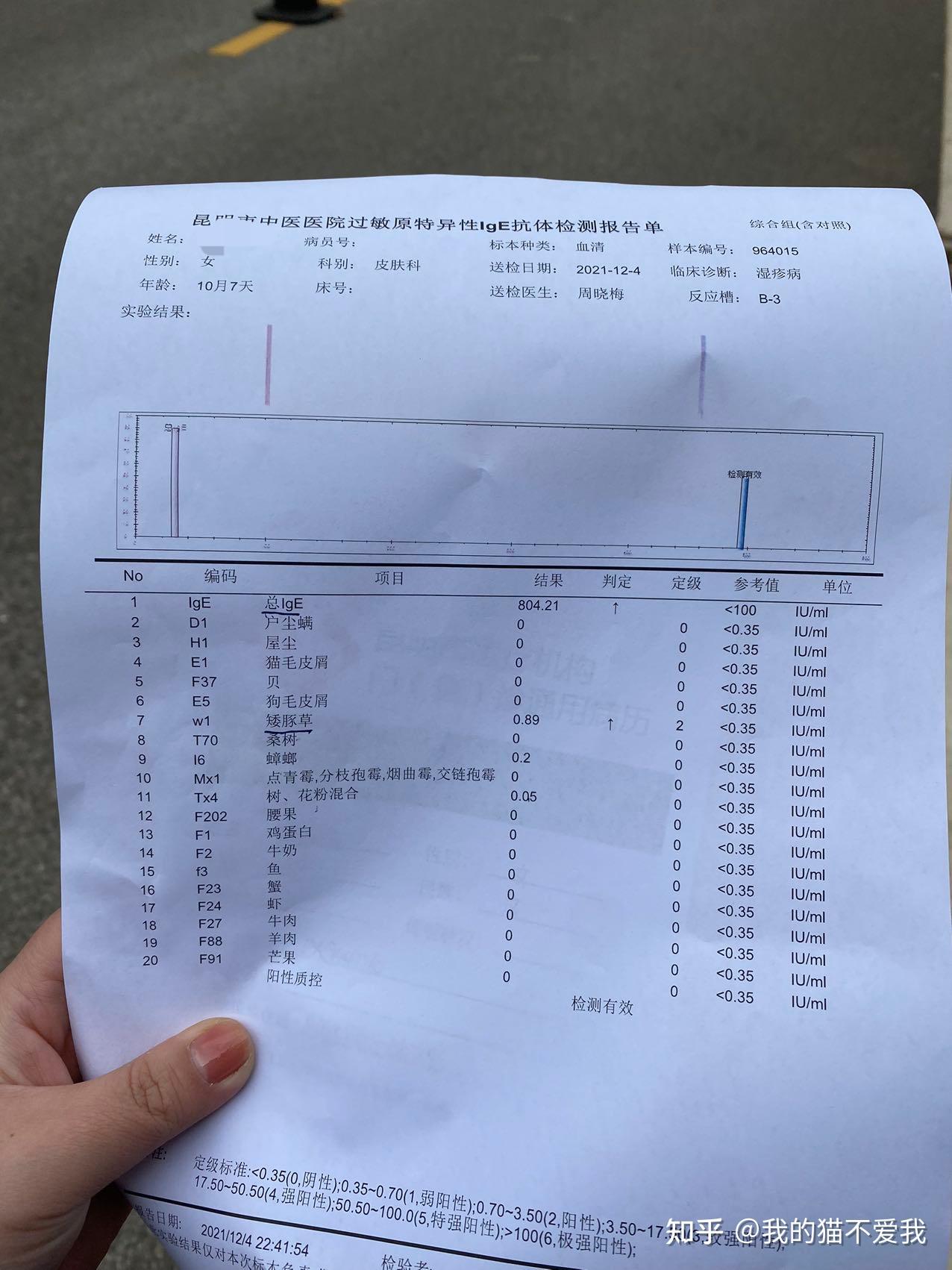 查过敏源需多少钱