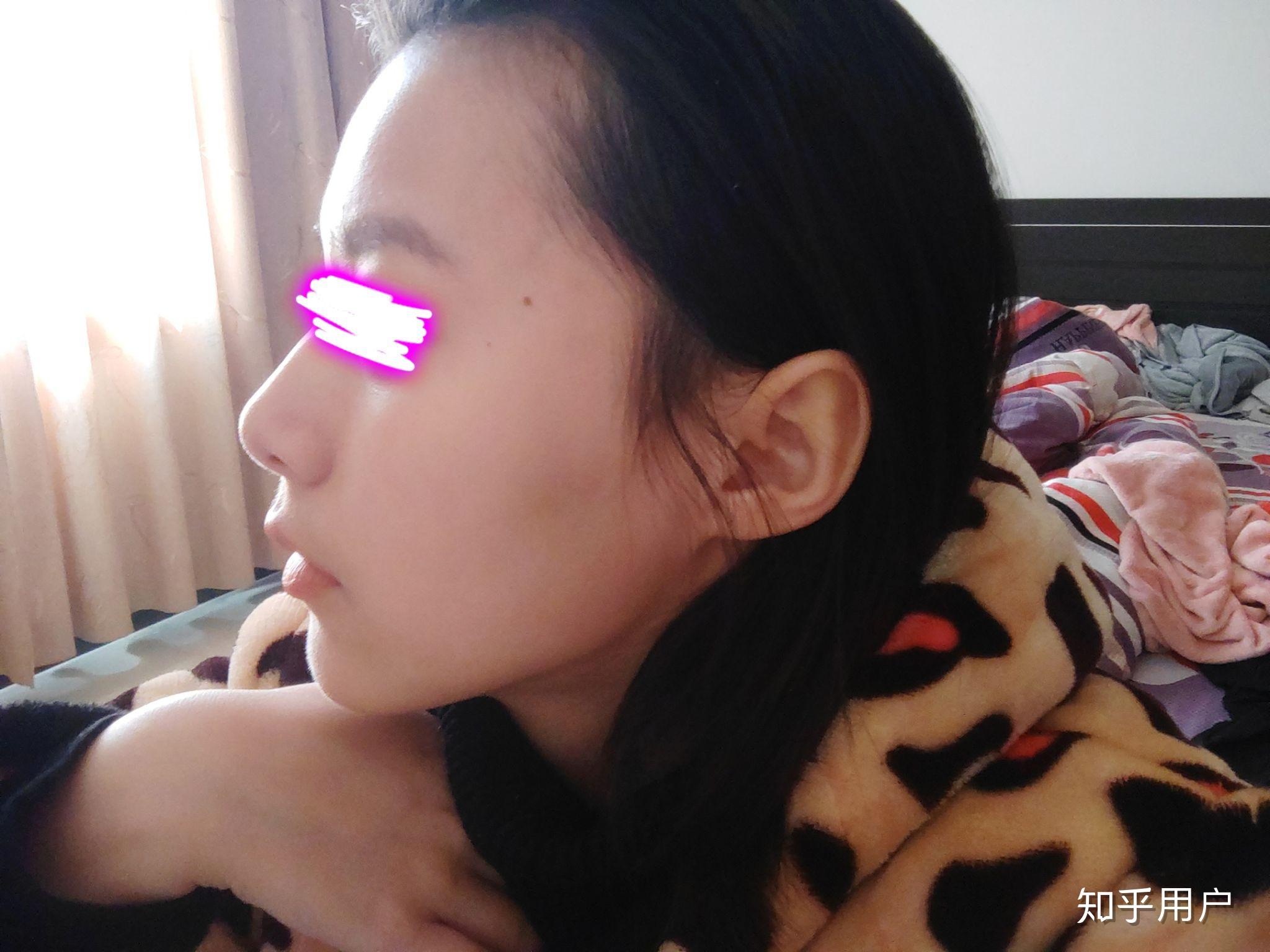 额头平是怎么样的体验