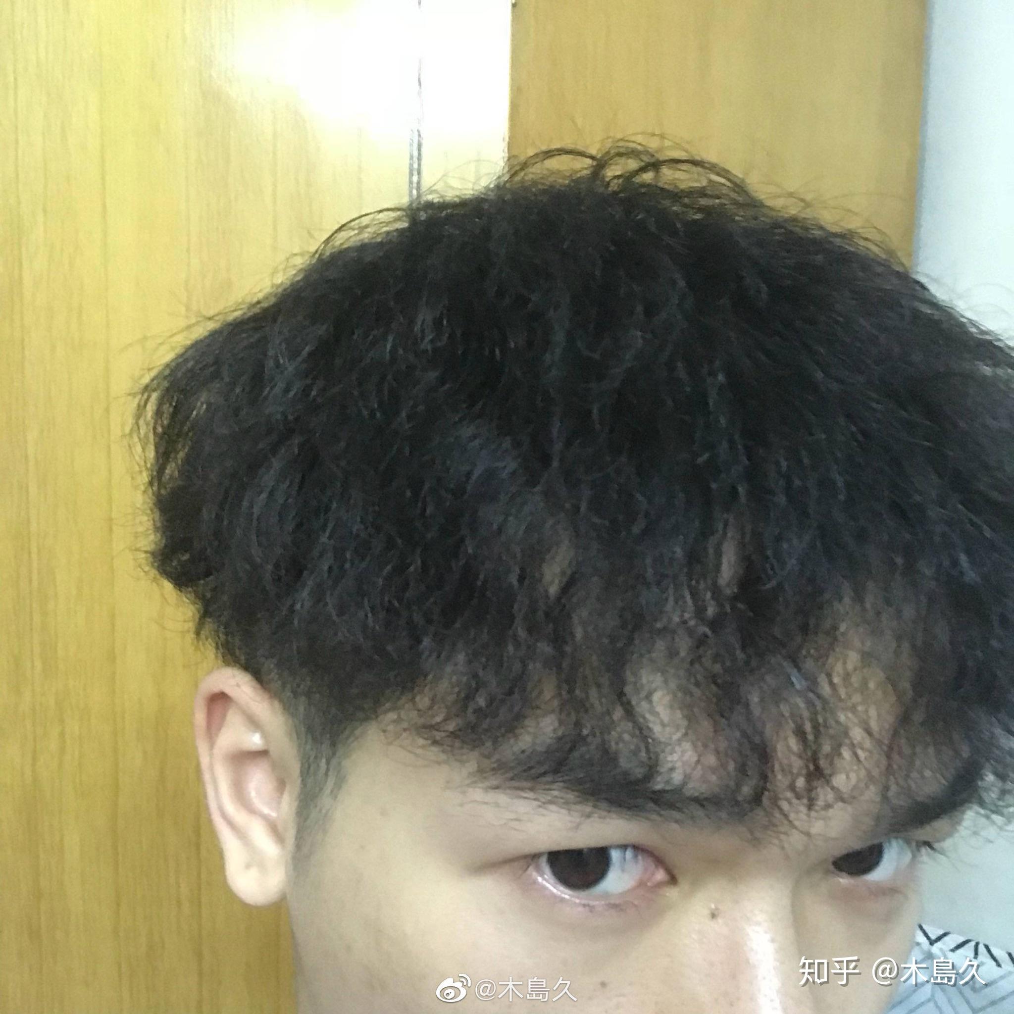 男生自来卷适合什么样的短发