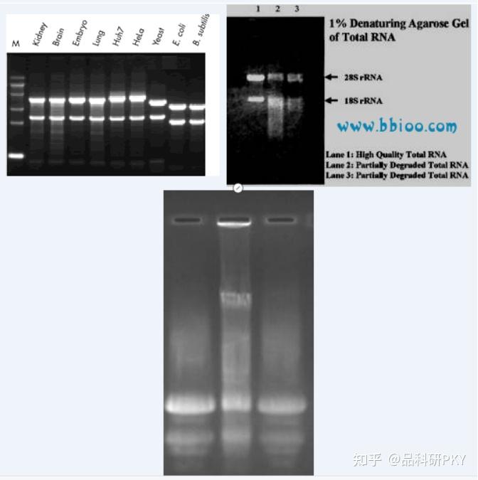 RNA 的琼脂糖凝胶电泳实验原理和步骤 - 知乎