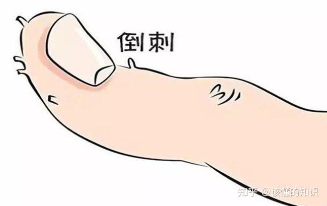 手指上的倒刺,是缺乏维生素吗? - 知乎