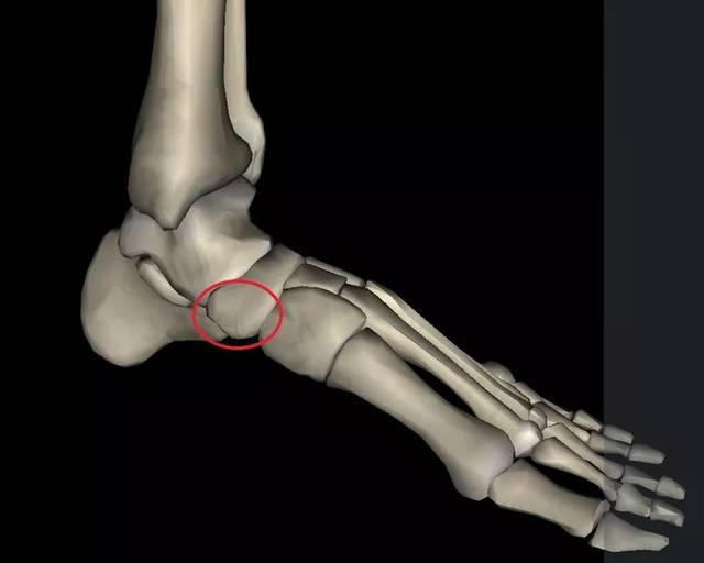 足舟骨突出按压疼痛