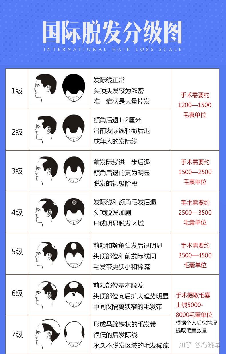 价位怎么样,秃顶坐下来得多少钱?