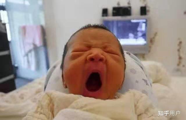 新生儿患有溶血性黄疸该怎么办? - 知乎