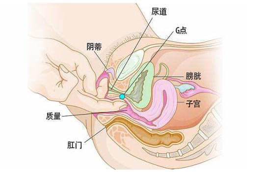 女性前列腺肥大图片