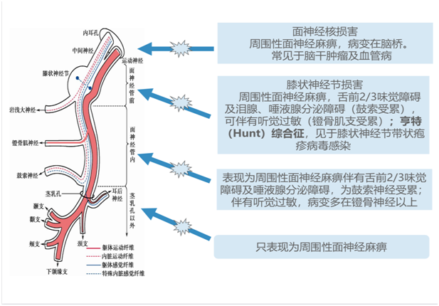 神内临床笔记5 12对颅神经 - 知乎