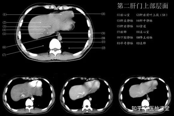 【经典】1小时读懂腹部CT - 知乎