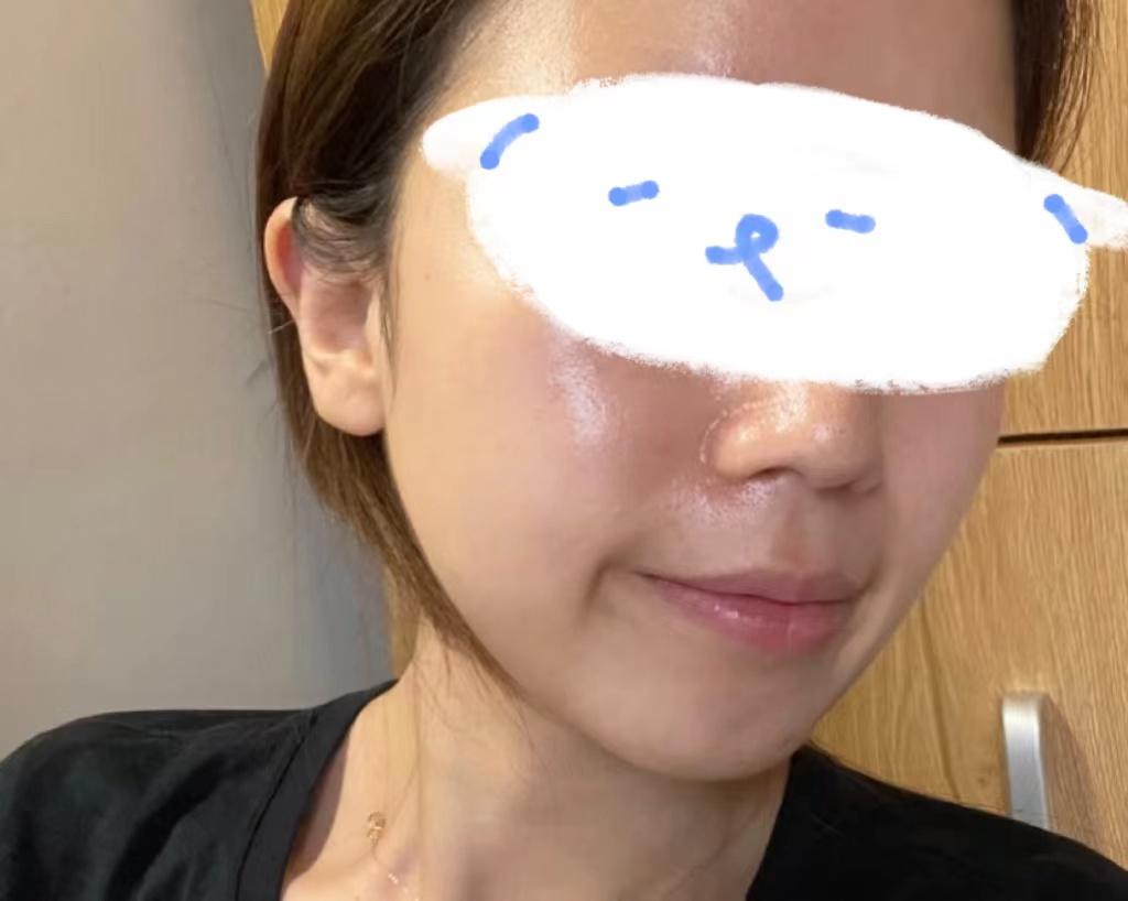 脸出油很厉害该怎么办