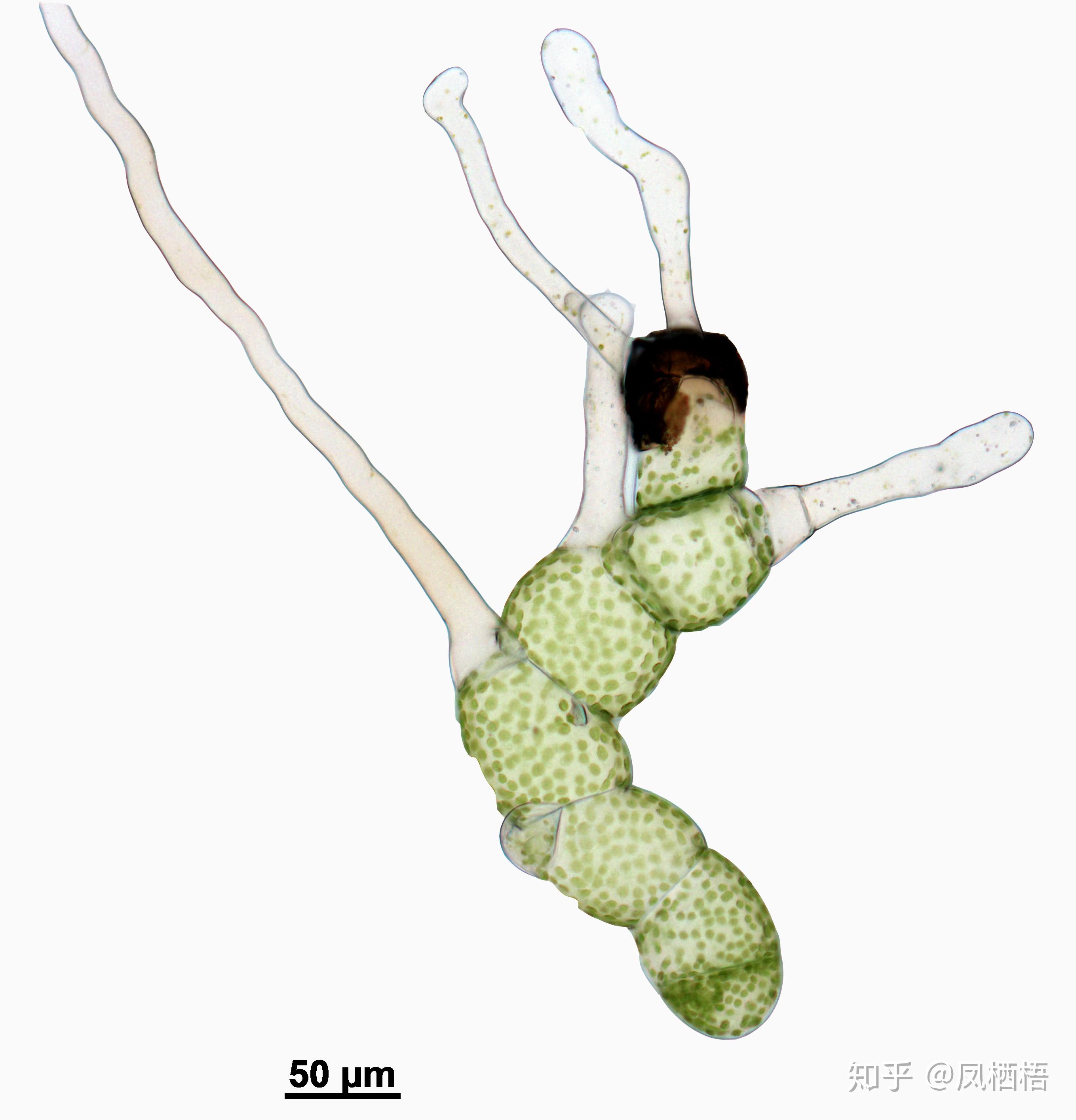 这是蕨类的孢子，为什么在十倍镜下像是一串葡萄，是多个孢子的聚合体？ - 知乎